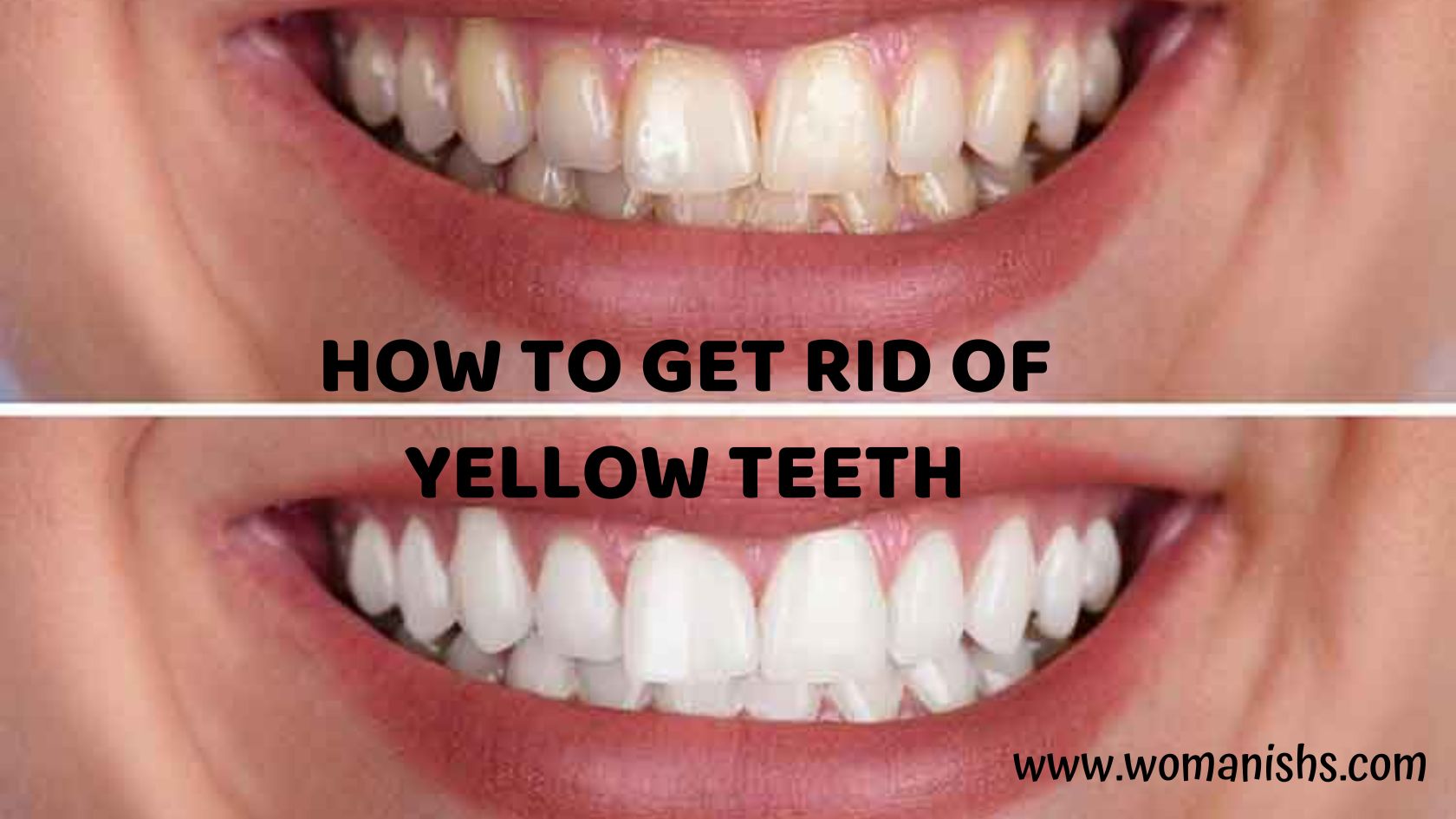 How to Get Rid of Yellow Teeth